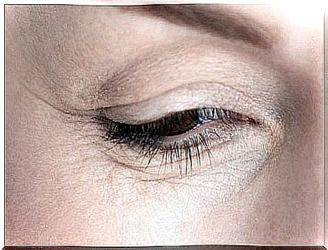 Eyes with wrinkles from premature aging