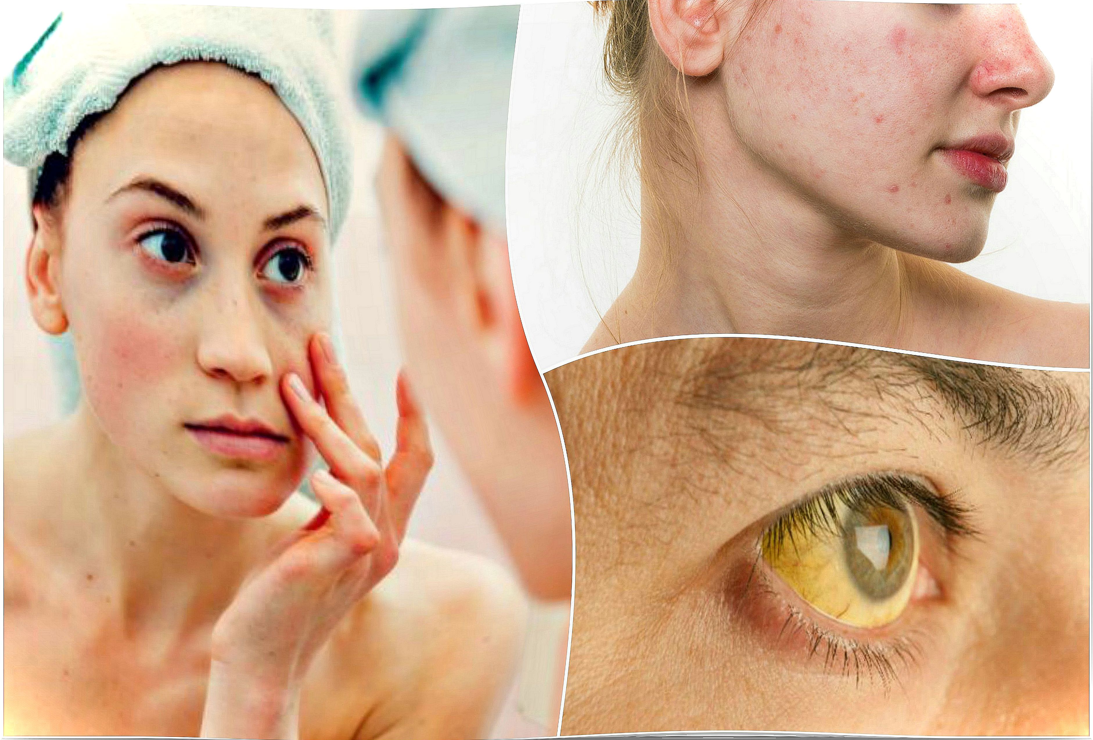 7 signs of nutritional deficiencies on your face