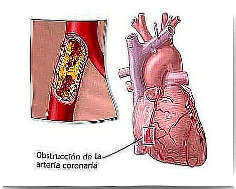 8 everyday habits that can cause heart problems