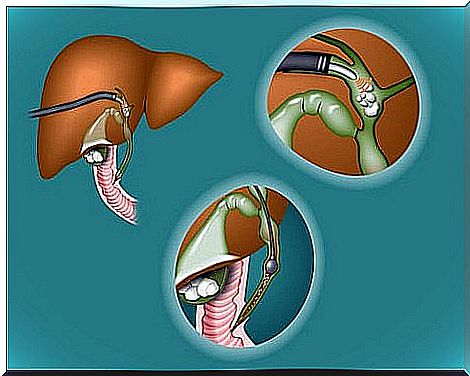 gallbladder