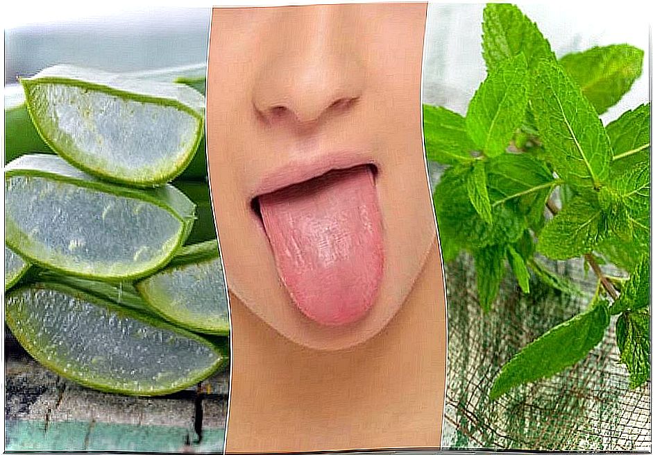 Relieve tongue blisters with 6 naturally derived treatments